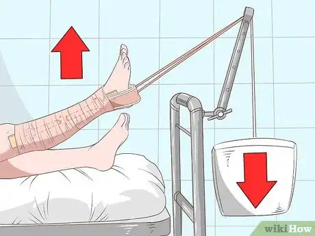 Imagen titulada Apply a Skin Traction Step 8
