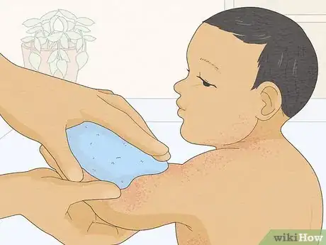 Imagen titulada Treat Baby Heat Rash Step 4