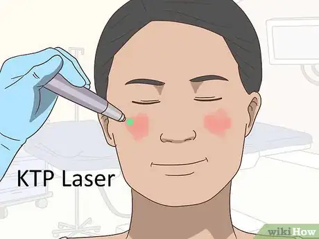 Imagen titulada Improve Your Skin Complexion Step 25
