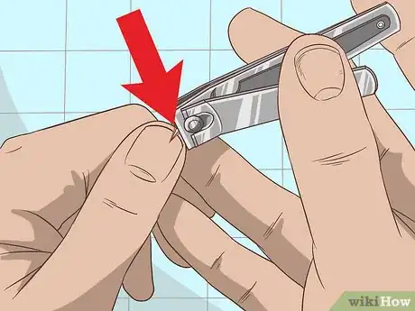 Imagen titulada Remove a Deep Splinter Step 2