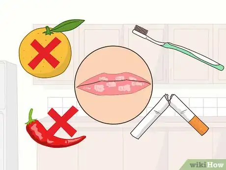 Imagen titulada Cure Lichen Planus Step 4