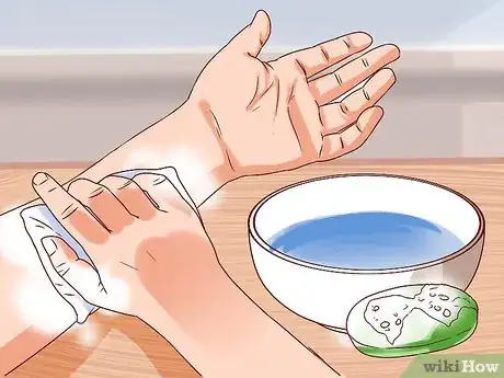 Imagen titulada Treat a Human Bite Step 4