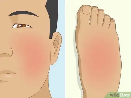 Imagen titulada Reduce Foamy Urine Step 8