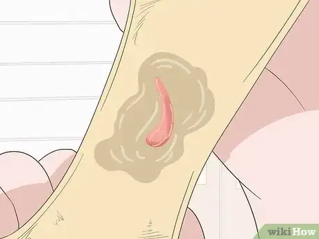 Imagen titulada Tell the Difference Between a Period and a Miscarriage Step 3