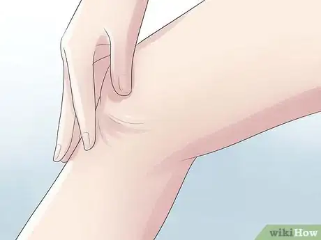 Imagen titulada Know if You Have a Baker's Cyst Step 3