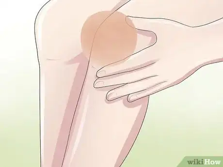 Imagen titulada Know if You Have a Baker's Cyst Step 1