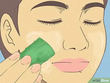Imagen titulada Get Rid of Dry Skin Step 25