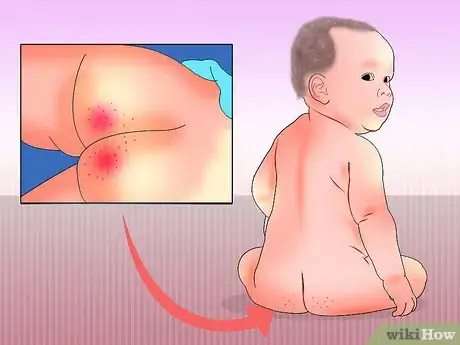 Imagen titulada Treat Diarrhea in Newborns Step 15