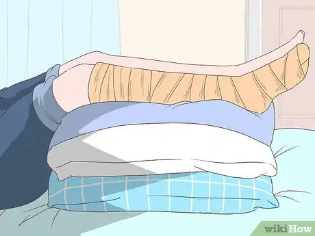 Imagen titulada Reduce Swelling After Surgery Step 1