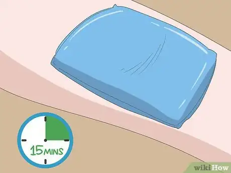 Imagen titulada Get a Boil to Come to a Head Step 1
