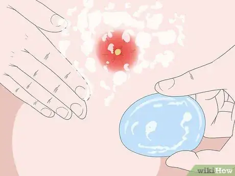 Imagen titulada Get a Boil to Come to a Head Step 9