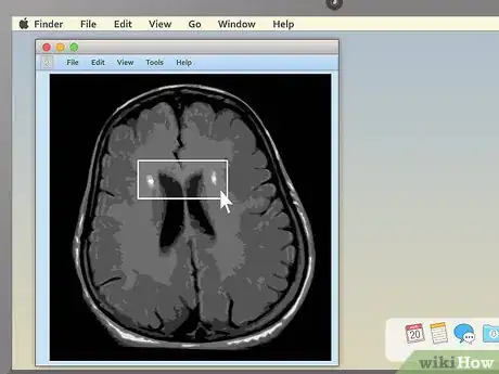 Imagen titulada Read an MRI Step 13