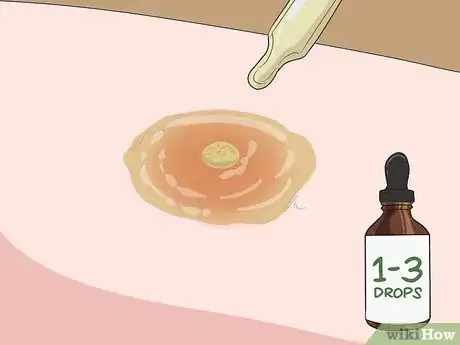 Imagen titulada Get a Boil to Come to a Head Step 5