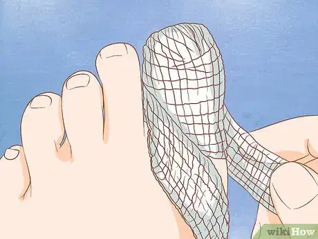 Imagen titulada Help a Toenail Grow Back Quickly Step 2