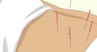 reducir los fibromas de forma natural