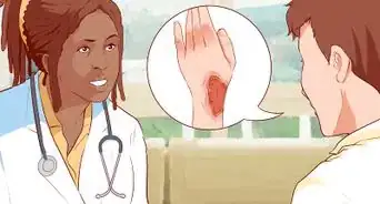 tratar una quemadura facial causada por una plancha rizadora para evitar cicatrices