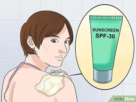 Imagen titulada Remove Keloid Scars at Home Step 2