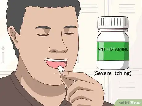 Imagen titulada Cure Lichen Planus Step 8