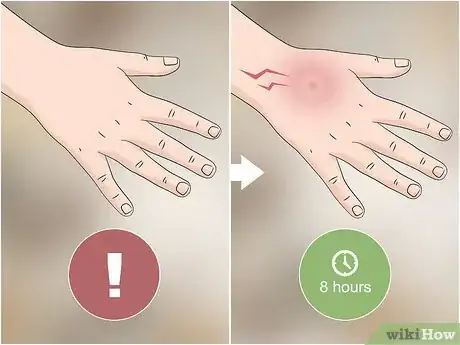 Imagen titulada Identify a Brown Recluse Step 9