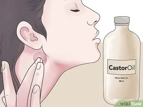 Imagen titulada Treat an Infected Sebaceous Cyst Step 6