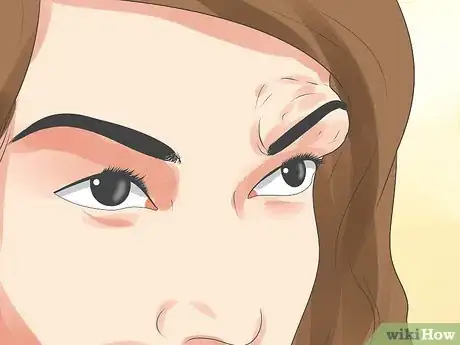 Imagen titulada Recognize an Eyelid Cyst Step 3