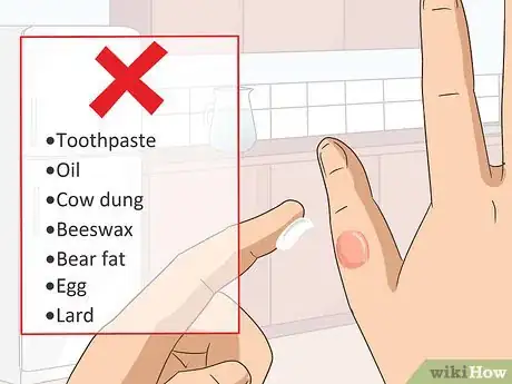 Imagen titulada Treat a Blistering Burn on Your Finger Step 9