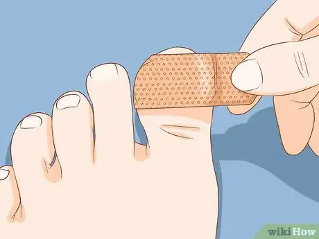 Imagen titulada Help a Toenail Grow Back Quickly Step 7