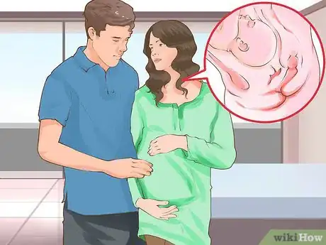 Imagen titulada Check a Cervix for Dilation Step 3