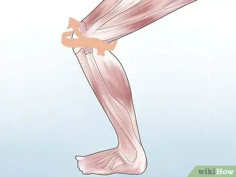 Imagen titulada Know if You Have a Baker's Cyst Step 2