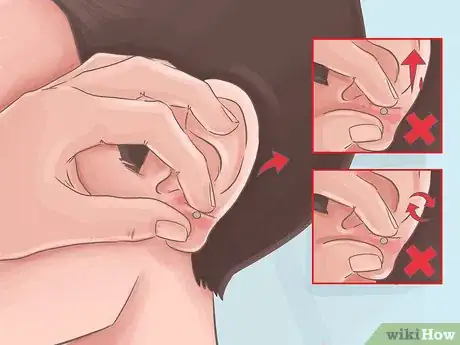 Imagen titulada Heal Piercings Step 6