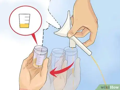Imagen titulada Help a Male Child Provide a Urine Sample Step 14