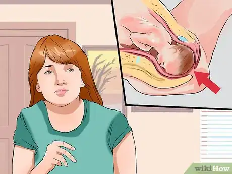 Imagen titulada Care for an Episiotomy Postpartum Step 14