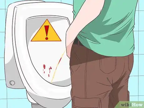 Imagen titulada Know if You Have Epididymitis Step 3