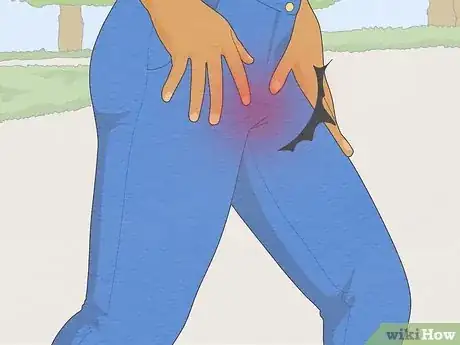 Imagen titulada Treat Vaginal Cysts Step 2