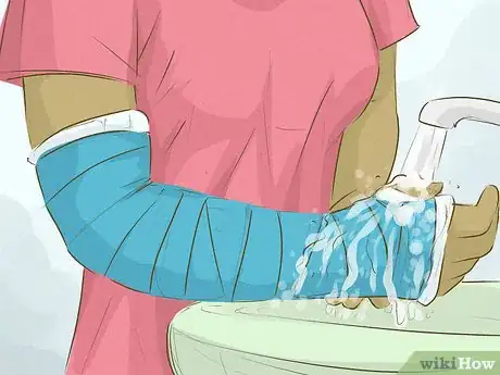 Imagen titulada Have Fun With a Broken Arm Step 13