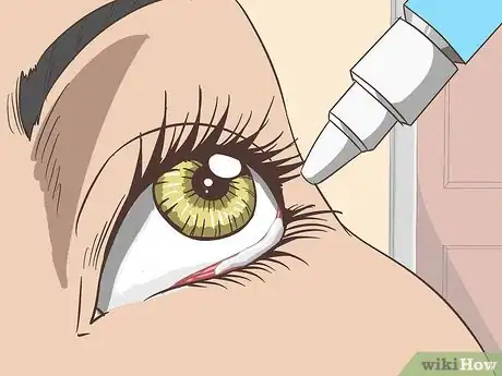 Imagen titulada Treat Dry Eyes Step 5