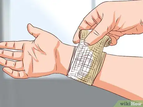 Imagen titulada Treat a Human Bite Step 6