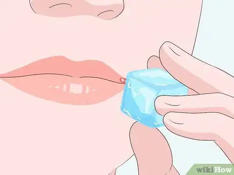Imagen titulada Get Rid of a Cold Sore Step 12