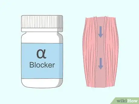 Imagen titulada Lower Blood Pressure Quickly Step 23