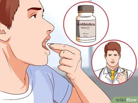 Imagen titulada Quickly Get Rid of Laryngitis Step 6