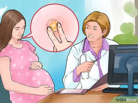 Imagen titulada Check a Cervix for Dilation Step 1