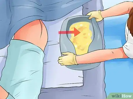 Imagen titulada Position a Bedpan Step 22