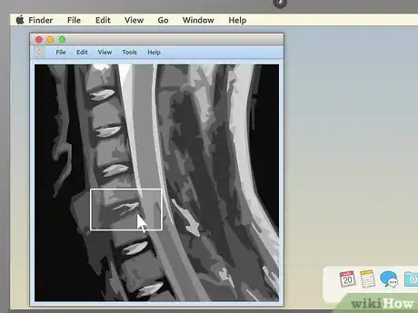 Imagen titulada Read an MRI Step 11