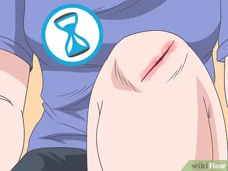 Imagen titulada Test for Diabetes at Home Step 4