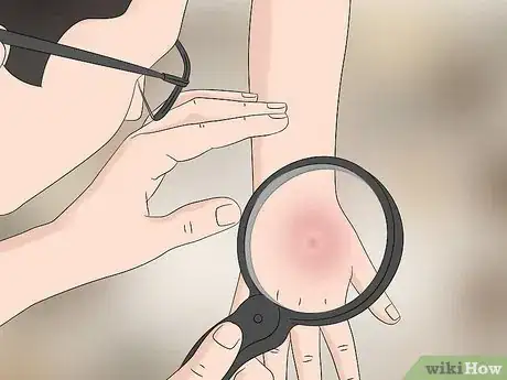 Imagen titulada Identify a Brown Recluse Step 11