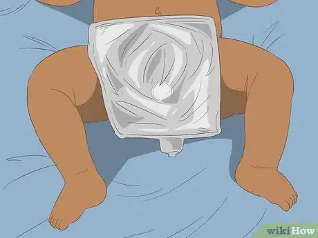 Imagen titulada Help a Female Child Provide a Urine Sample Step 12