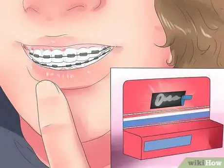 Imagen titulada Alleviate Orthodontic Brace Pain Step 7