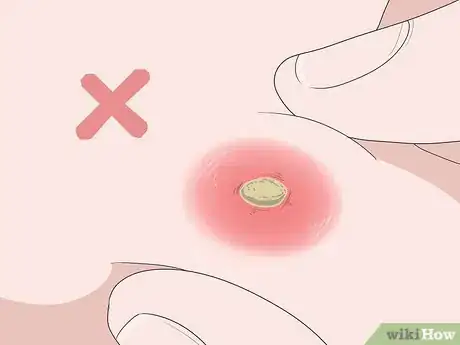 Imagen titulada Get a Boil to Come to a Head Step 6