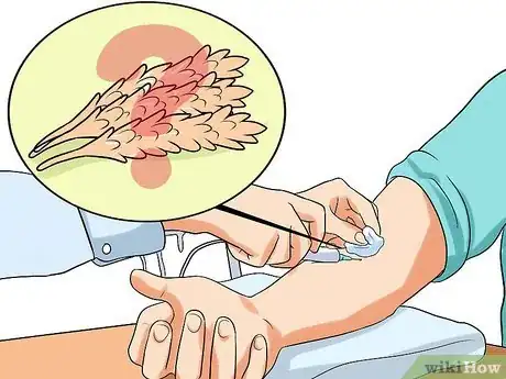 Imagen titulada Stop Severe Diarrhea Step 16