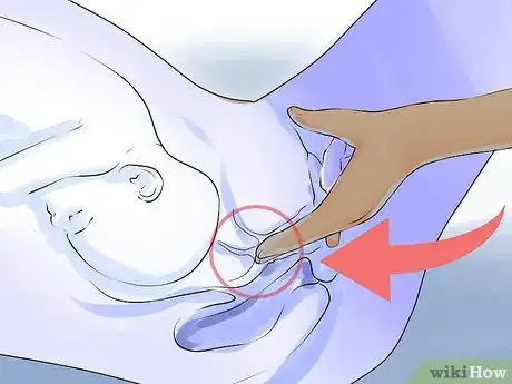 Imagen titulada Check a Cervix for Dilation Step 6